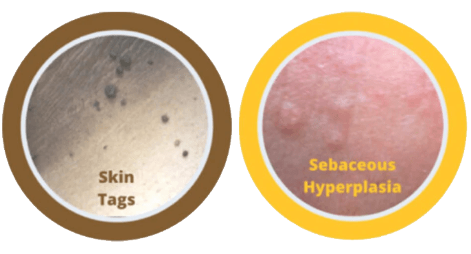 skin-conditions-treated-02