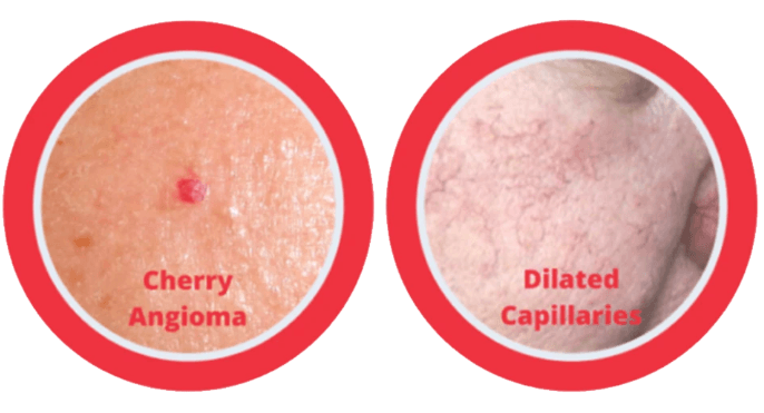 skin-conditions-treated